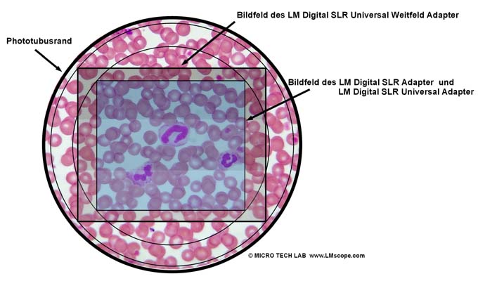 grand champ de vision avec LM adaptateur num�rique 
