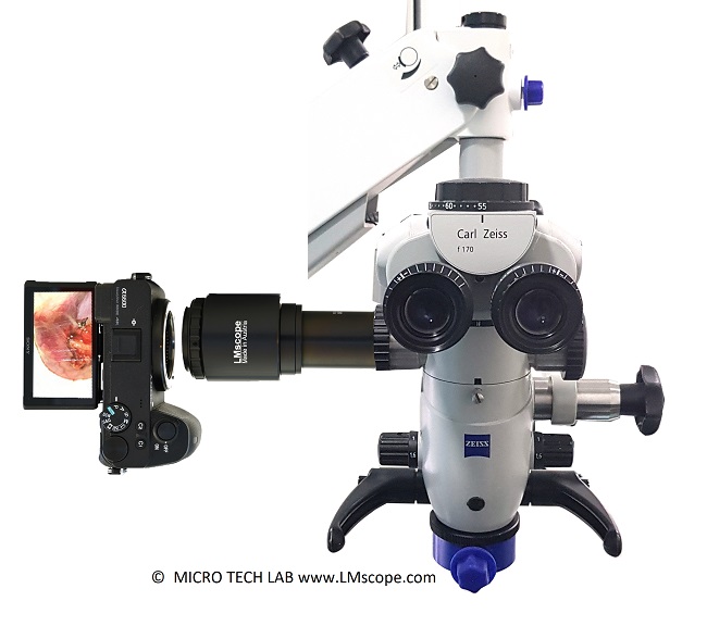 Adaptador de microscopio Zeiss OPMI para lámpara de hendidura y divisor de haz, compatible con cámaras modernas de fotograma completo, cámaras con sistema sin espejo y cámaras SLR digitales.