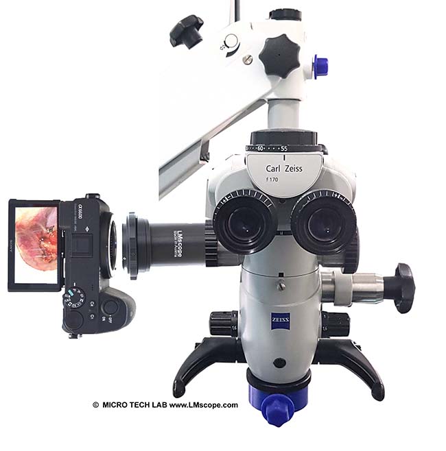 Zeiss OPMI: microscopio quirúrgico/lámpara de hendidura con divisor de haz, fototubo, adaptador para microscopio LM, cámaras digitales de alta calidad, DSLM/DSLR