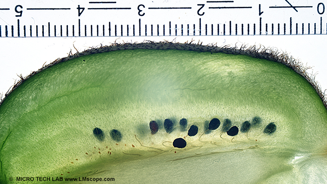 Ma�stab:Kalibrierung der Messsoftware ein gew�hnliches Lineal am Bildrand positionieren