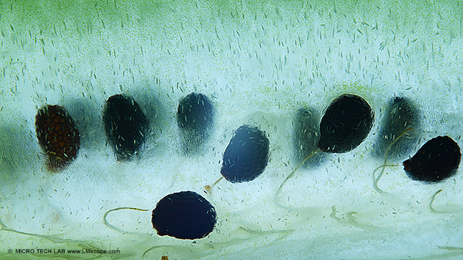 Kiwischeibe, Detailaufnahme bei  30x Mikroskopvergr��erung, LM Weitfeld Digitales LM Fotomikroskop mit motorisierten Stativ, Stackshot, Helicon Software, Bildstapel von 20 Einzelbildern