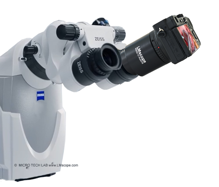 Montage moderner Consumer- oder Profikameras am Okulartubus Zeiss OPMI mit LM Adapter