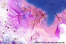 D�nnschicht: Gelatine geschmolzen