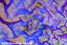 D�nnschicht: Gelatine geschmolzen