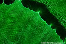 Laserbeugungsmikroskopie mit  Canon EOS DSLR