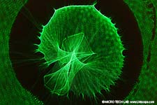 Laserbeugungsmikroskopie mit  Canon EOS DSLR