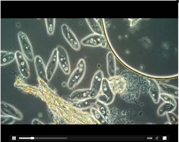 Wimpertiere (Ciliata / Infusoria)  unter dem Mikroskop